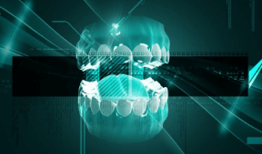 Innovation in Dental Implants